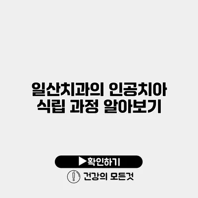 일산치과의 인공치아 식립 과정 알아보기