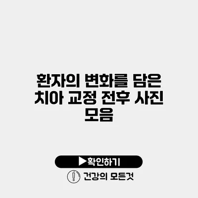환자의 변화를 담은 치아 교정 전후 사진 모음